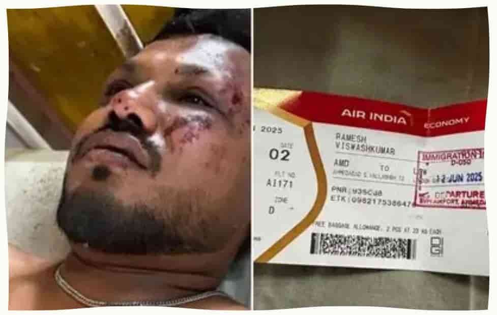 Alone and Injured AI 171 Crash Survivor Struggles Abroad